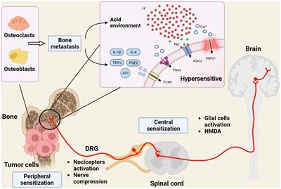 Ion channels in cancer-induced bone pain: from molecular mechanisms to clinical applications